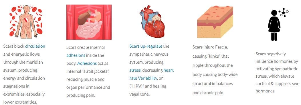Infographic illustrating the effects of scars on circulation, internal adhesions, nervous system regulation, fascia injury, and hormonal imbalances.